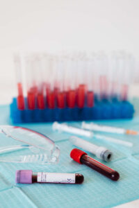 blood test to confirm healthy habits are working